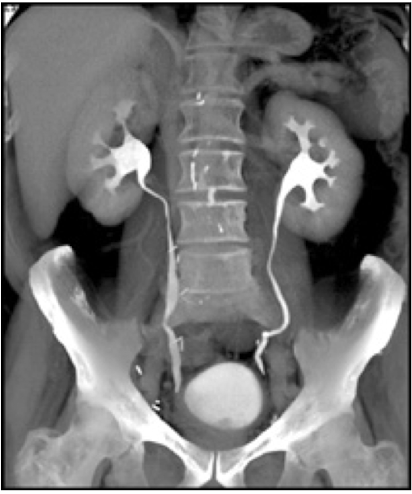 <p>CT scan using an IV contrast material to assess kidney, ureters, and bladder</p><p><em>Abdominal Radiograph</em></p>