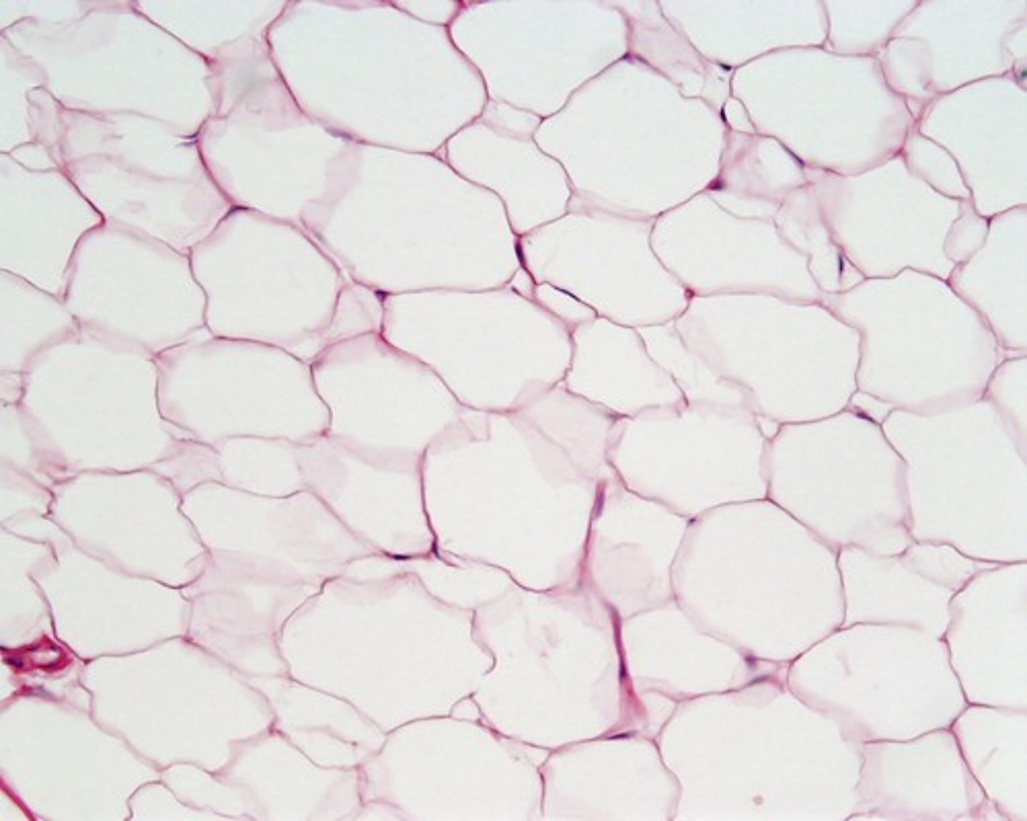 <p>Connective tissue in which fat is stored; has the cells distended by droplets of fat</p>