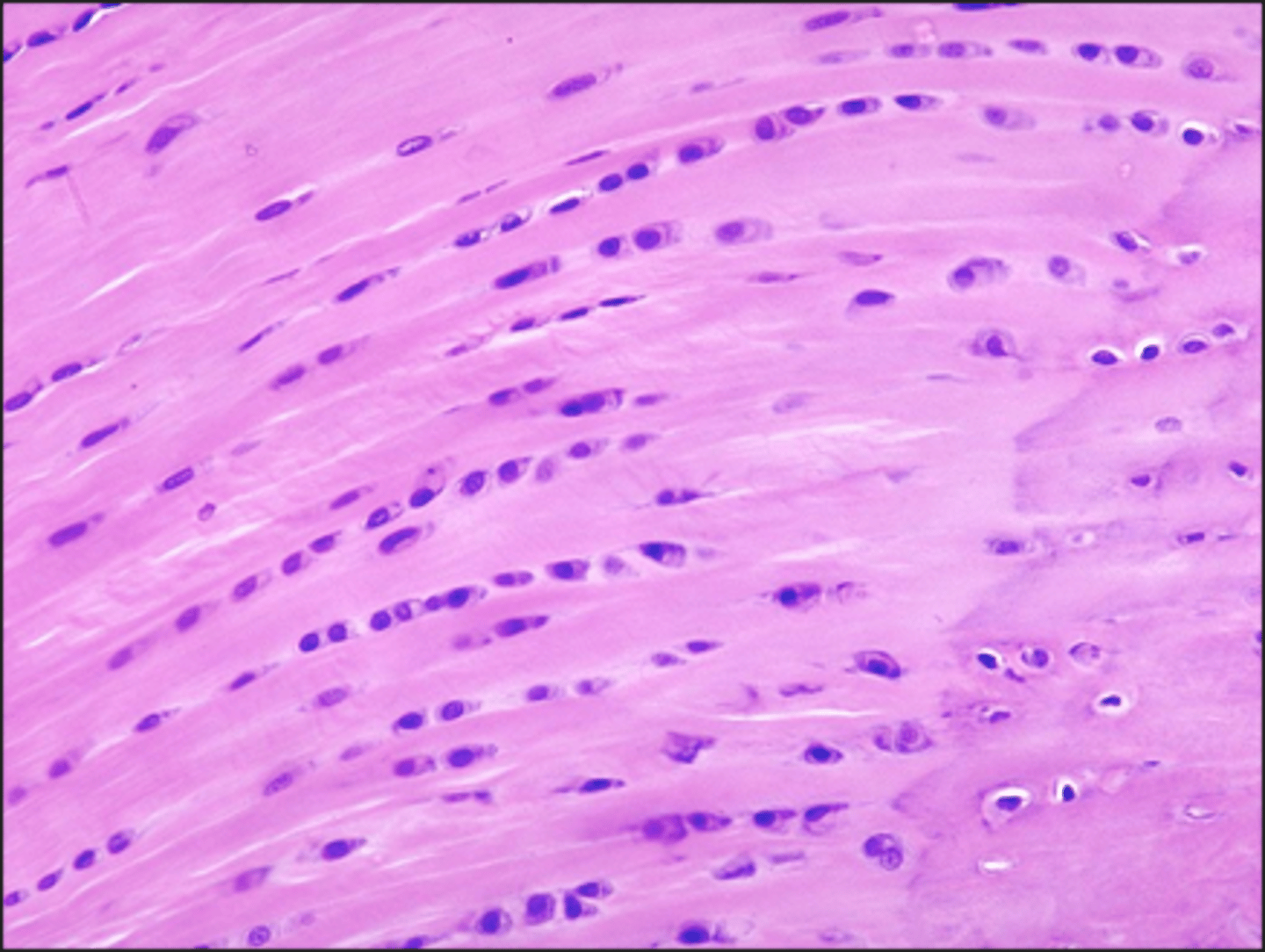 <p>identify the cartilage:</p>