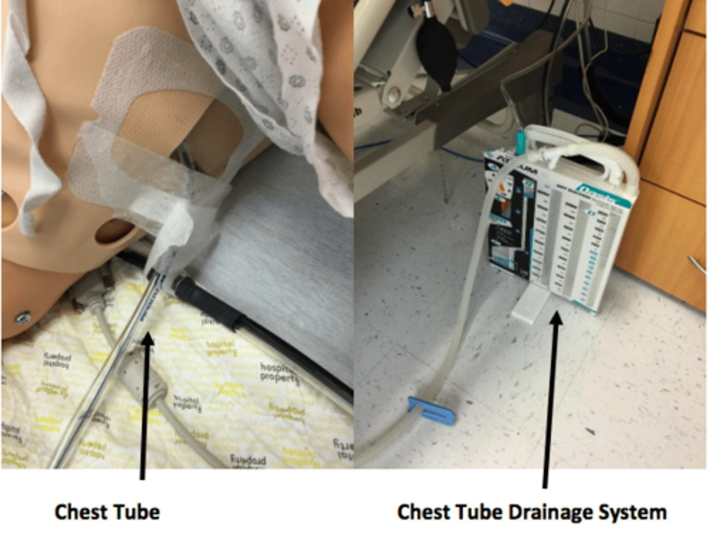 <p>- surgically inserted into lateral side of ribs</p><p>- drains excess fluid, air, blood, drainage</p><p>- can operate off of gravity or pump</p><p>- don't pull/kink/dislodge tubes, don't kick over collection container</p>