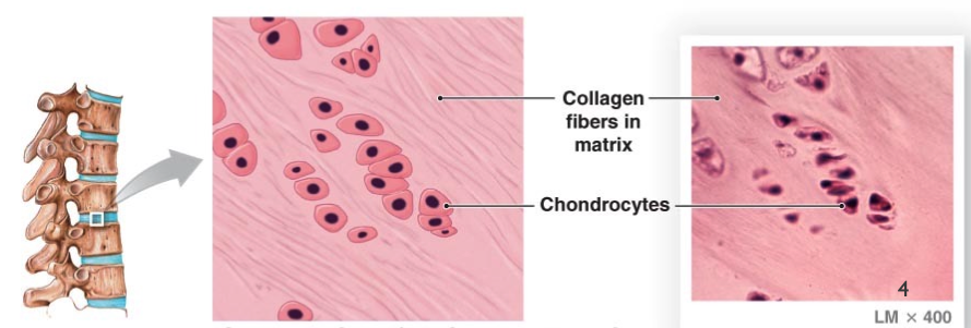<ul><li><p>resists compression and tension</p></li><li><p>very dense&nbsp;</p></li><li><p>rows of thick collagen in matrix&nbsp;</p></li><li><p>annulus fibrosis and knee meniscus&nbsp;</p></li></ul><p></p>