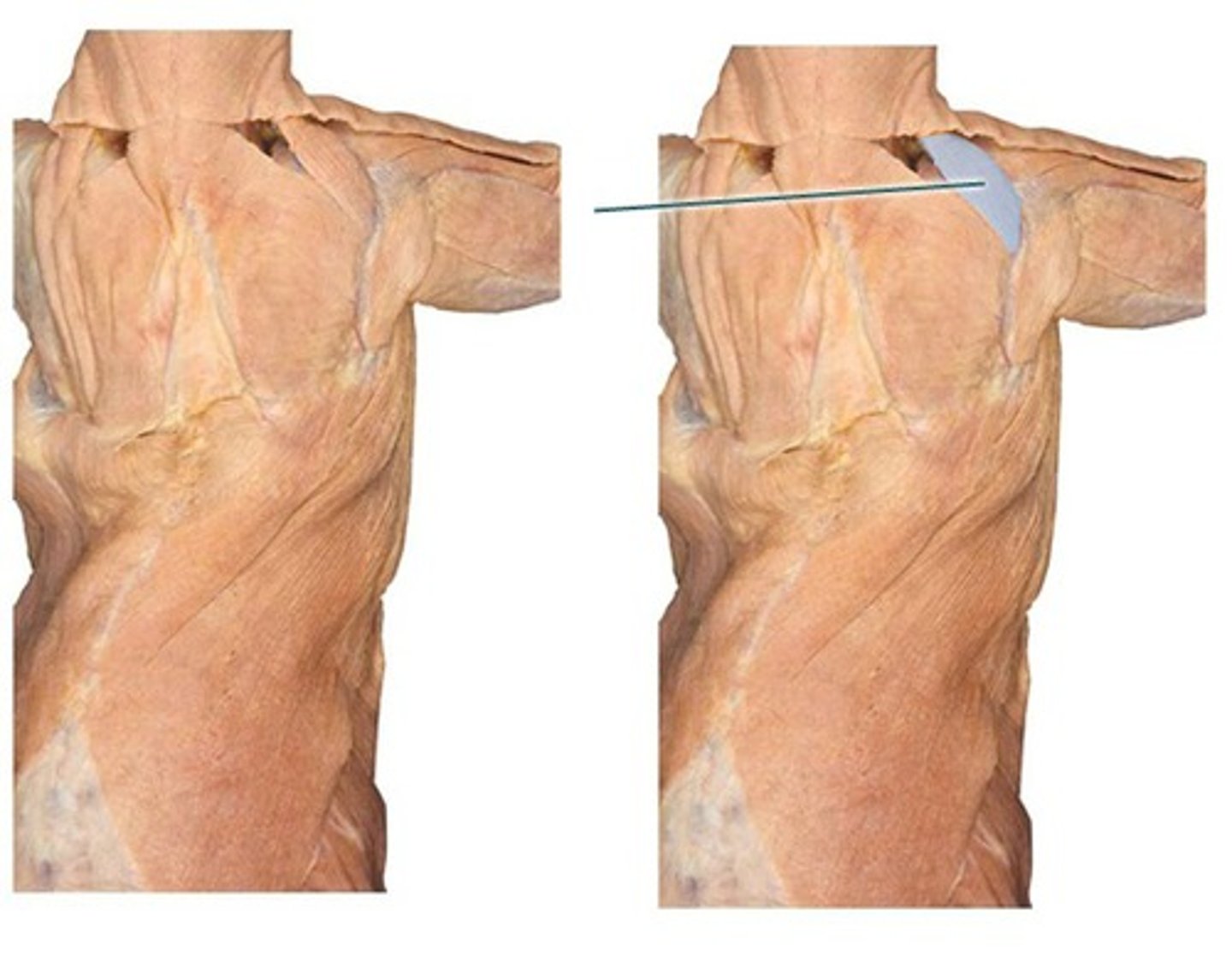 <p>origin: transverse processes of C1-C4</p><p>insertion: medial border of scapula superior to spine</p><p>action: elevates and adducts scapula</p>