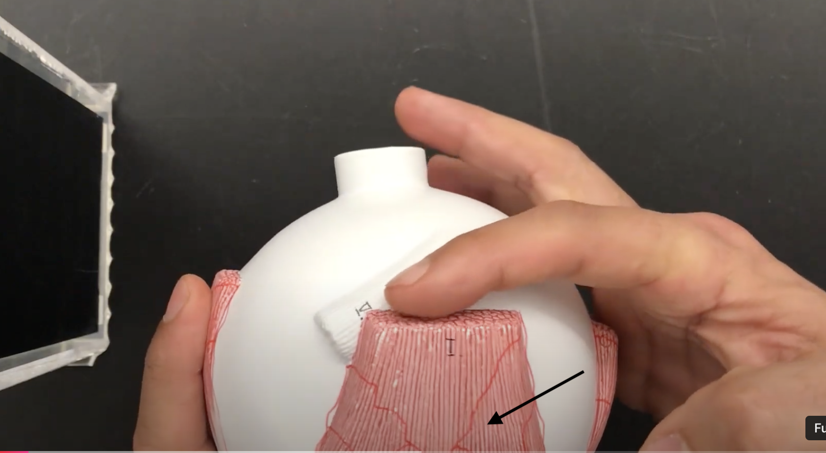 <p>What muscle is this?*****</p>