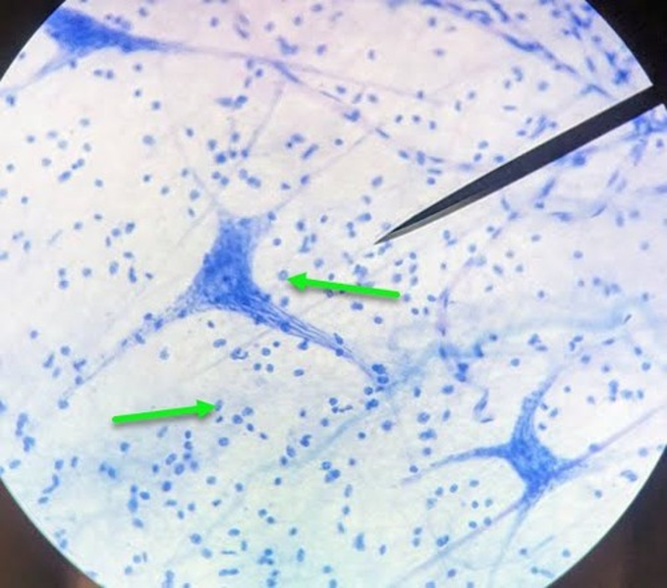 <p>Identify the cell indicated by several arrows.</p>