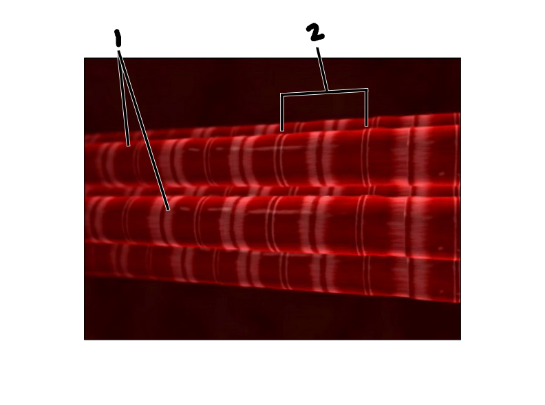 <p>Label the image</p>