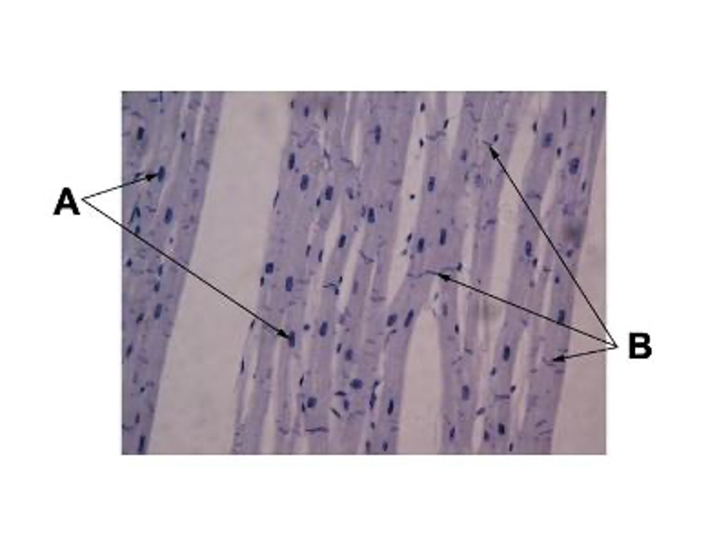 <p>What is structure B</p>