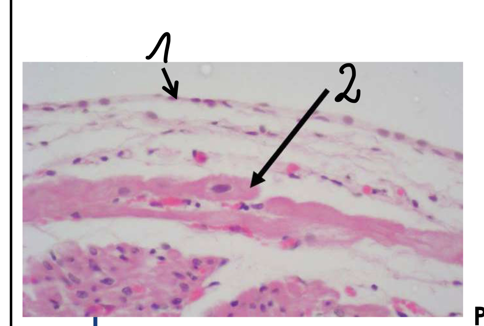 term image