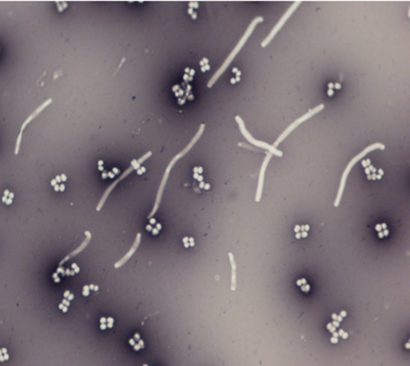 <p>Negative stains</p>