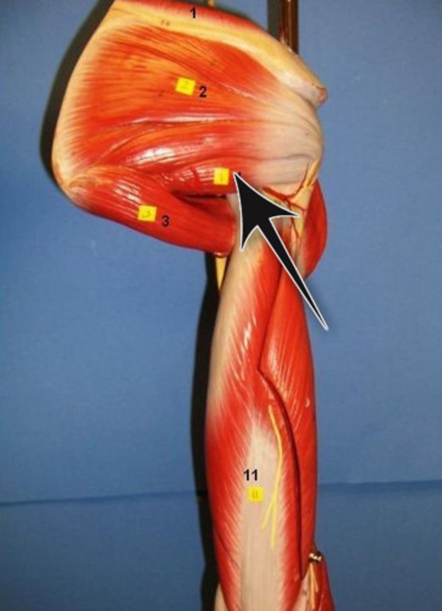 <p>posterolateral border of scapula</p>