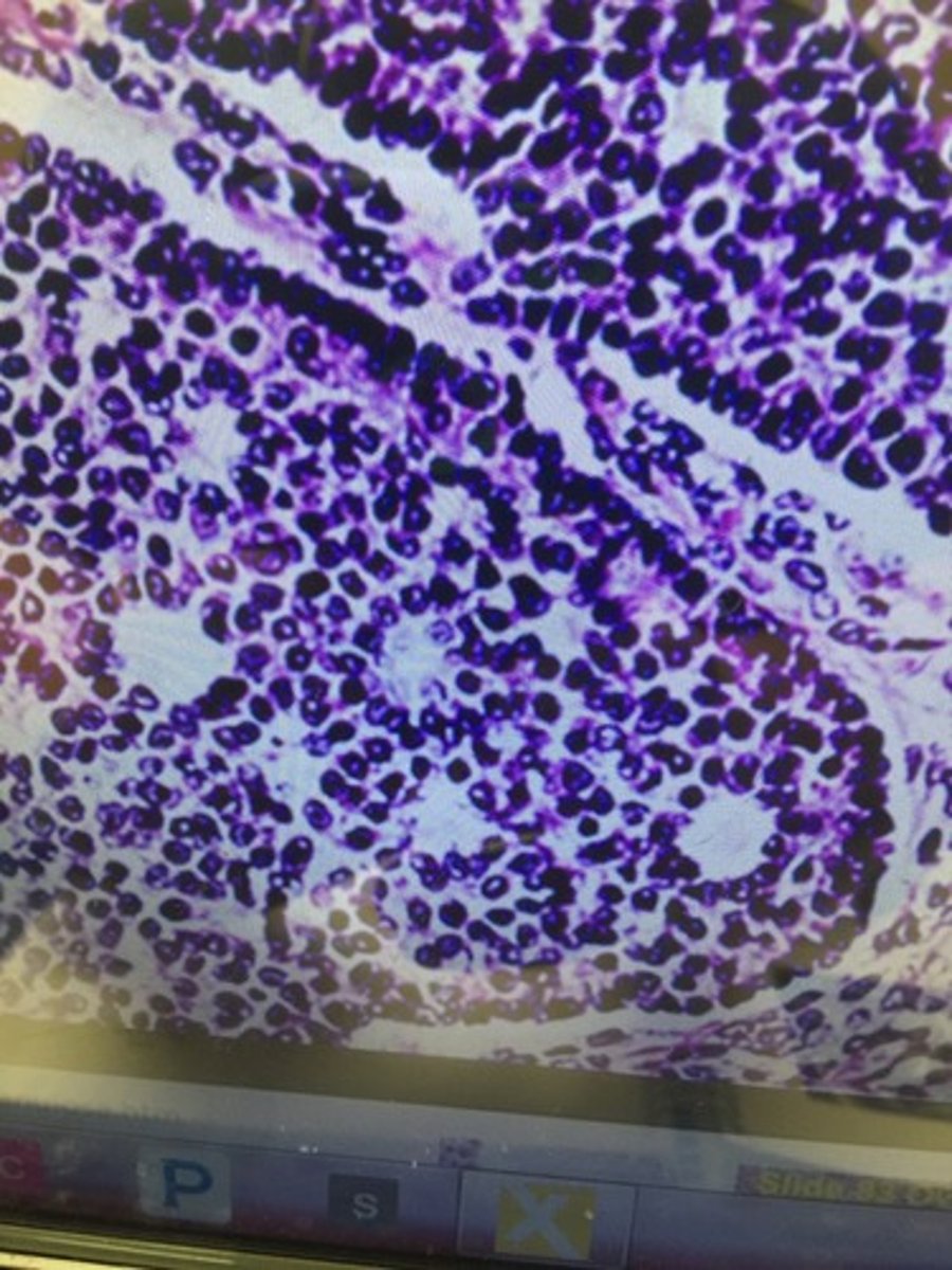 <p>What smaller cells that form a layer around the primary follicles are pictured above?</p>