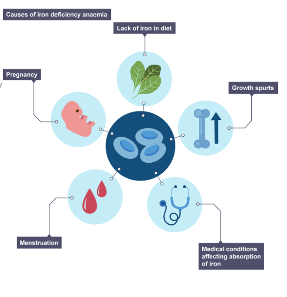 <p>causes of IDA</p>