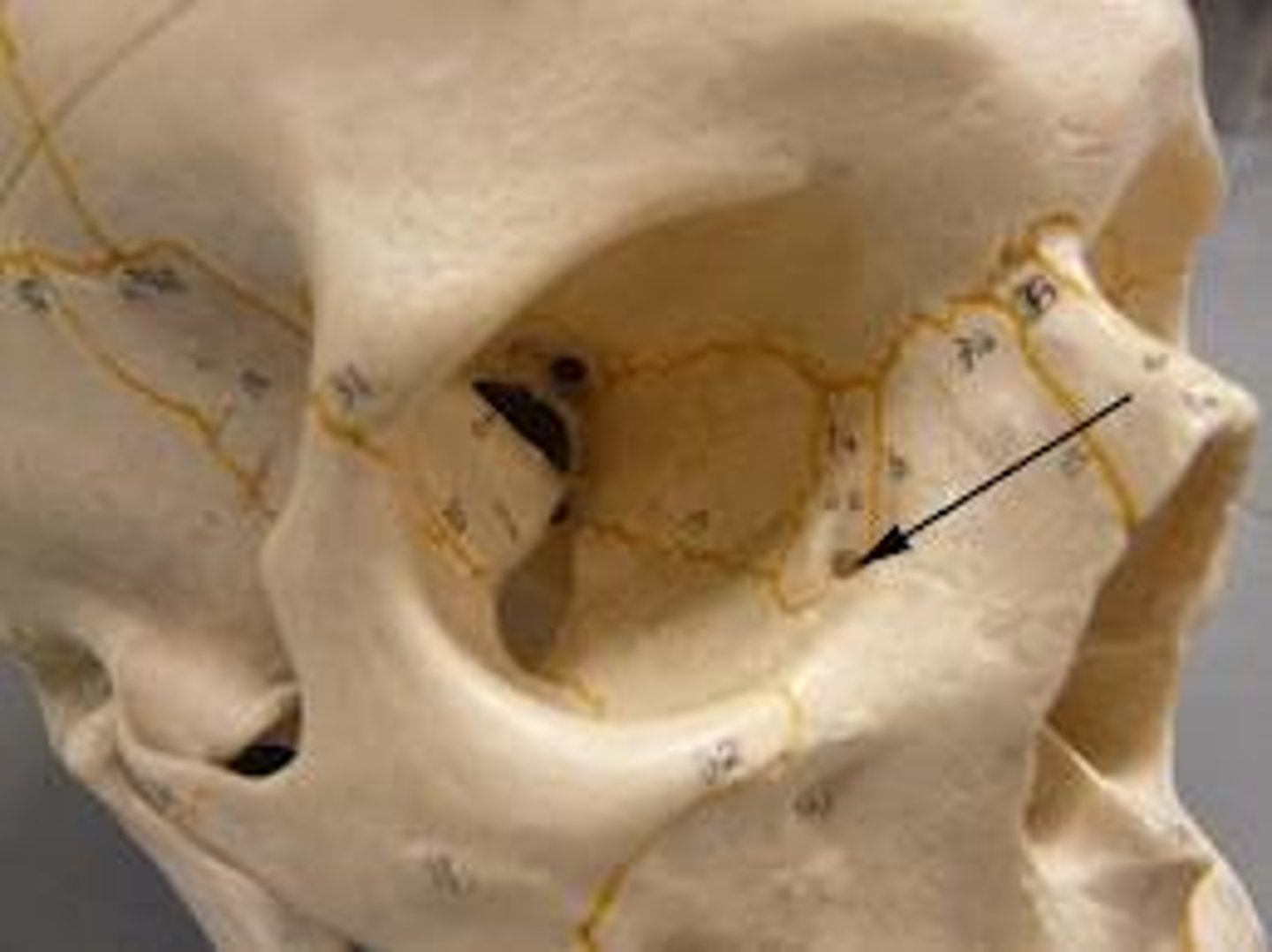 <p>hole located at the distal end of the lacrimal bone; tear duct</p>