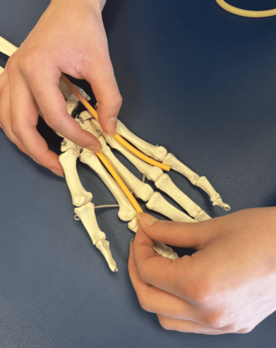<p>What is this muscle?</p>