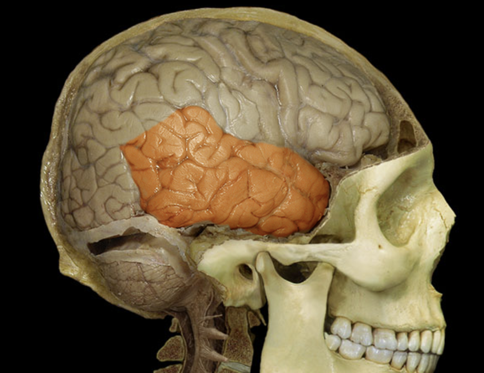 term image