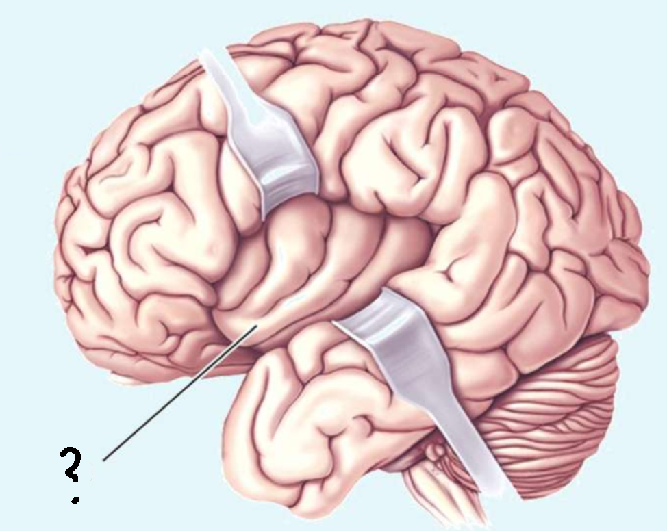 <p>Which part of the brain is this?</p>