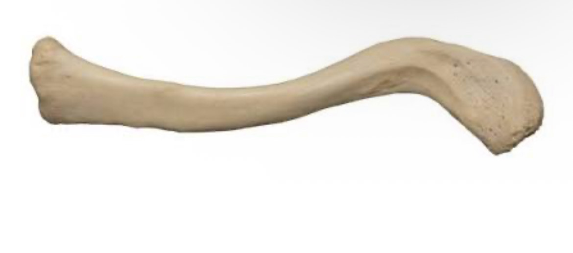 <p>what bone is this?</p>