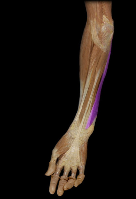 <p>Flexor carpi ulnaris</p>
