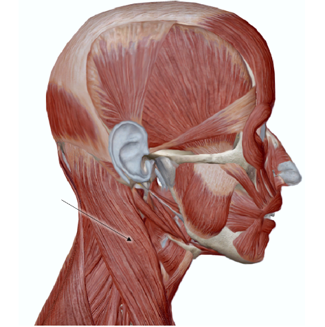 <p>Name the muscle</p>
