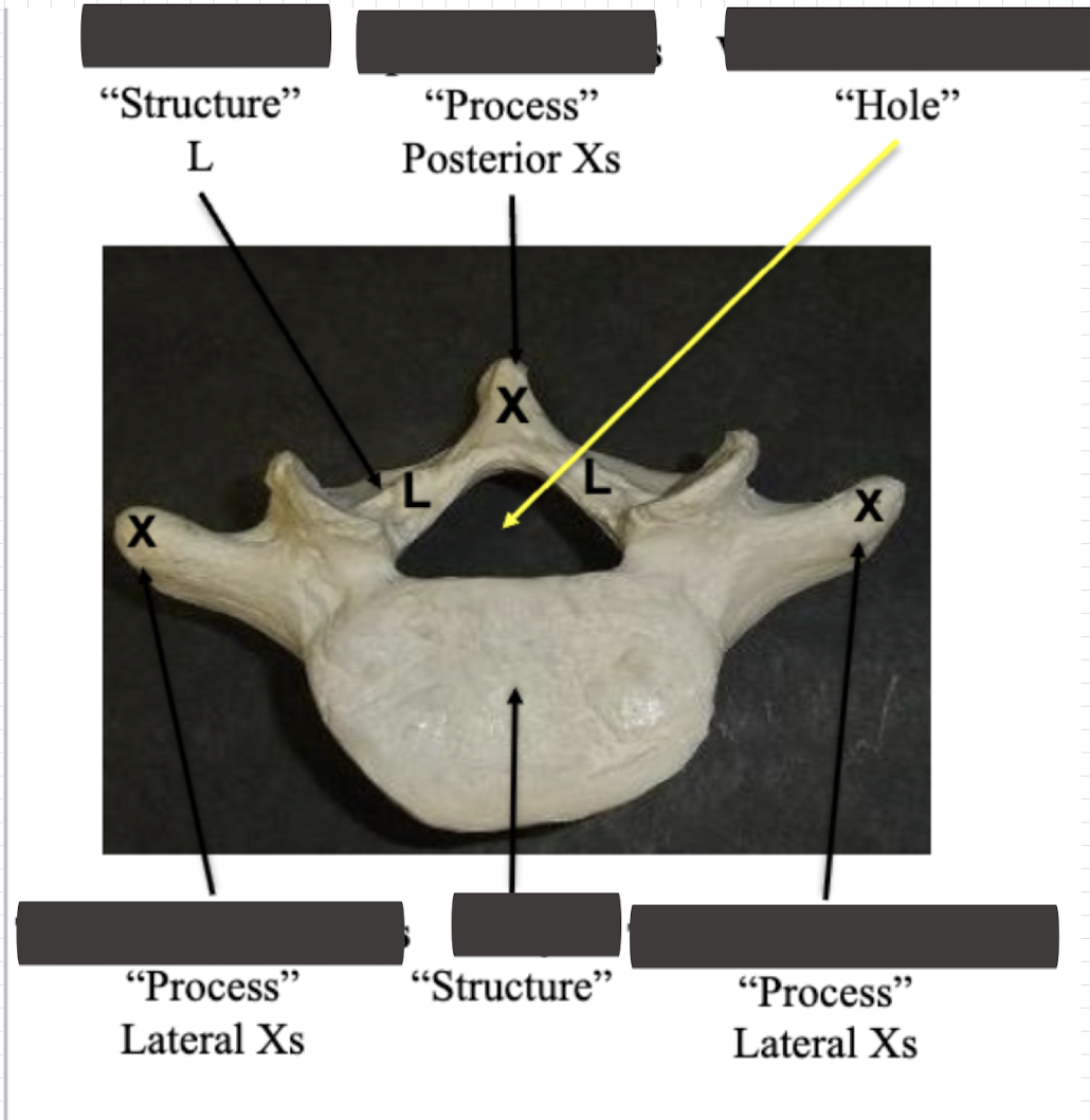 <p>Label the side <strong>structure (L) </strong></p>