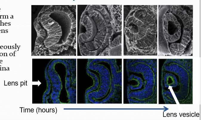 <p>Formation of the optic cup and the future neural retina. </p>