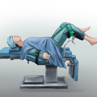 <p>Dorsal Recumbent Position</p>