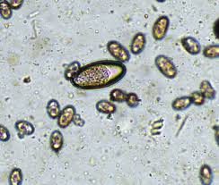 <p>Dentostomella translucida</p>