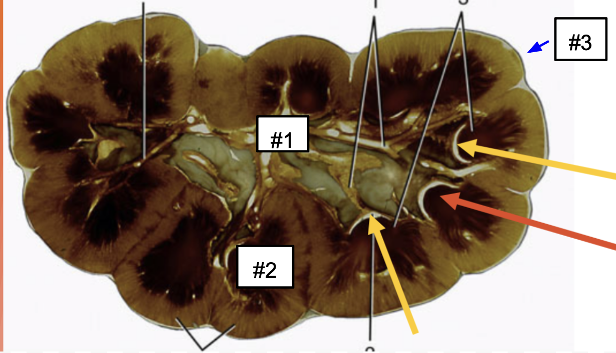 <p>#3?</p>