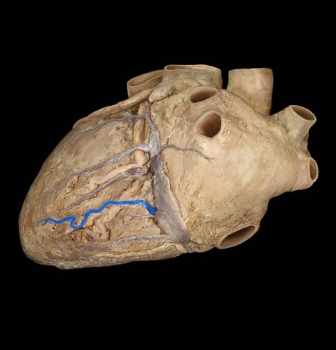 <p>runs alongside the posterior interventricular artery (PDA)</p>