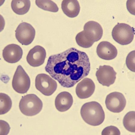 <p>What is this leukocyte?</p>