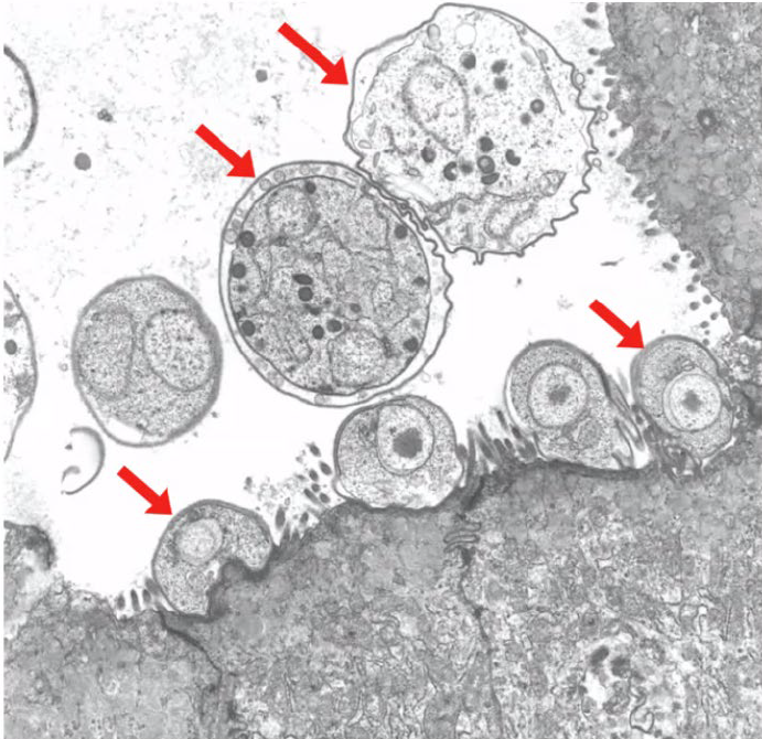 <p>What are the structures pointed by arrows?</p><p>A-Cryptosporidium spp. </p><p>B-Salmonella spp.</p><p>C-E. coli</p><p>D-Strongy/us spp.</p>