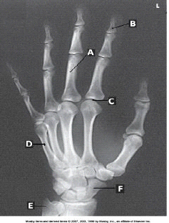 Letter B in the figure above labels the _____ phalanx of the _____ digit.