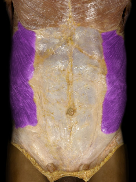<ul><li><p>Action: Unilateral: rotation of trunk, Bilateral: flexion of trunk (sit-ups), Compression of anterior abdominal wall and viscera (increases intra-abdominal pressure)</p></li><li><p>Origin: Ribs and costal cartilages 5-12</p></li><li><p>Insertion: Linea alba, Ilium (crest)</p></li><li><p>Innervation: Ventral rami of T8-L1 spinal nerves</p></li></ul><p></p>