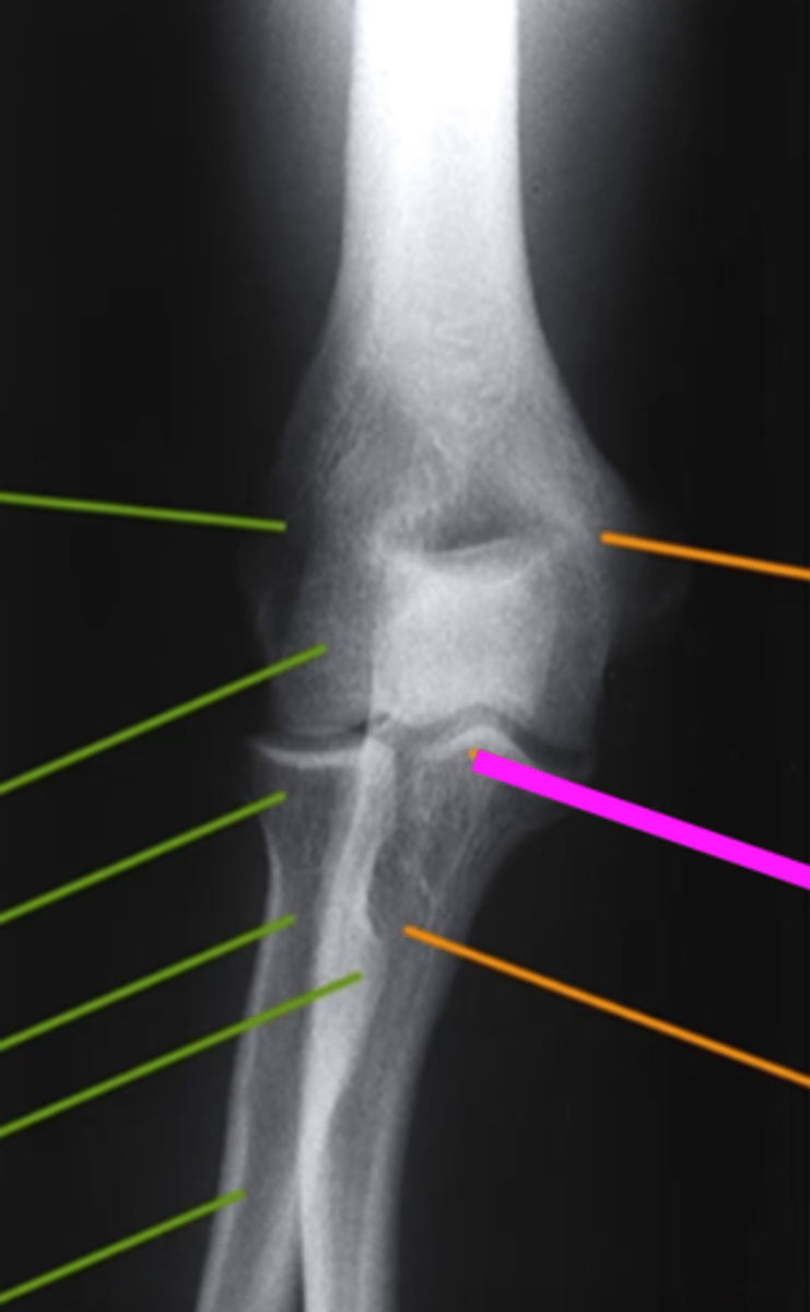 <p>what does the pink line point to?</p>