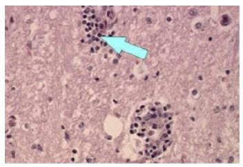 <ul><li><p><strong>Post-Mortem</strong>: Under the microscope, viral inclusions called Negri bodies are found in the cytoplasm</p></li><li><p><strong>Vaccinate your pets!</strong></p><ul><li><p>There is an efficacious vaccine (inactivated virus) Vets, animal workers are routinely vaccinated</p></li></ul></li><li><p><strong>Prophylactics</strong>: Injection of Human antibodies against rabies virus</p></li></ul>