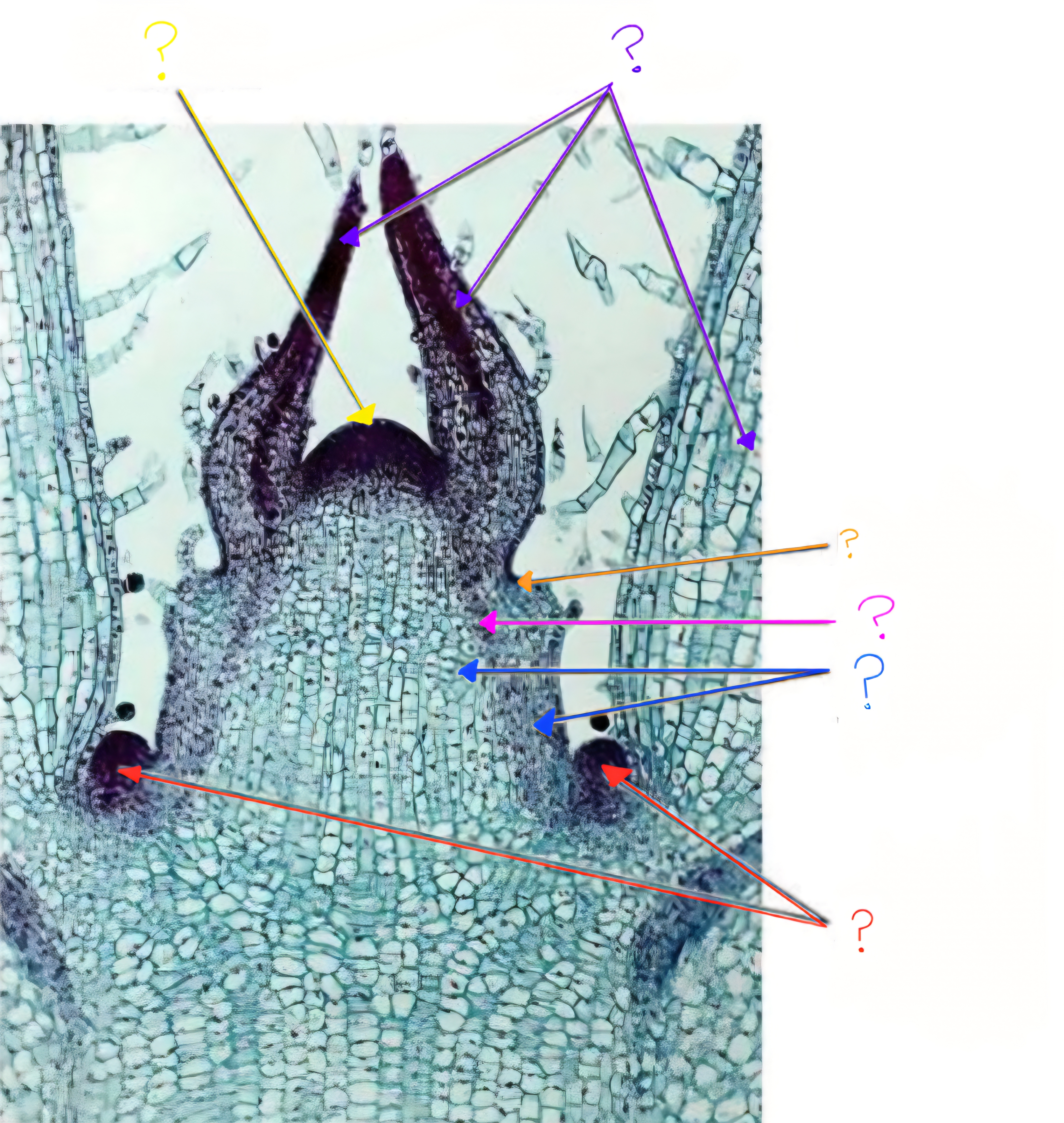 <p>What is labeled by the pink arrow?</p>