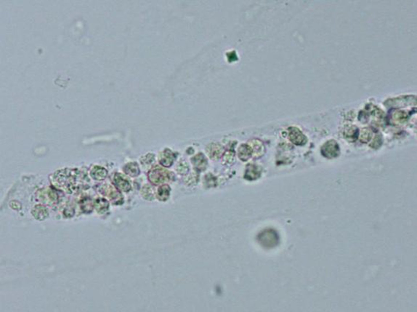 <p>Cast matrix containing WBCs</p><p>-sources of error= WBC clumps</p><p>-reporting= average number per lpf</p><p>-correlations= WBCs, Protein, LE</p>