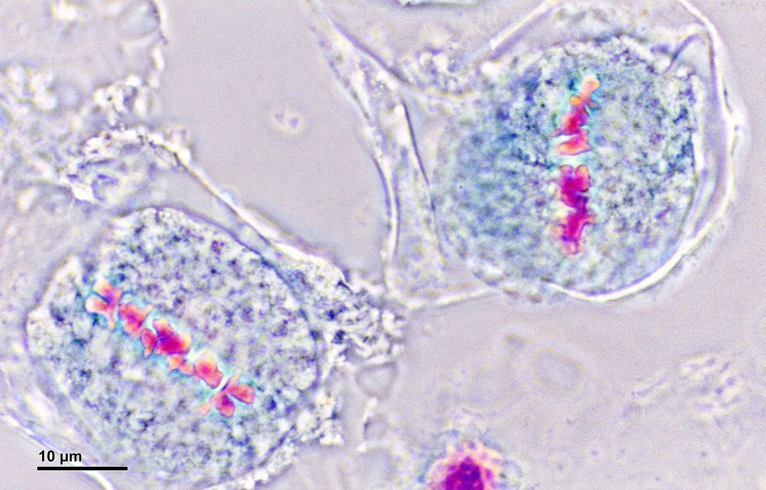 <p>what stage of cell division is this?&nbsp;</p>