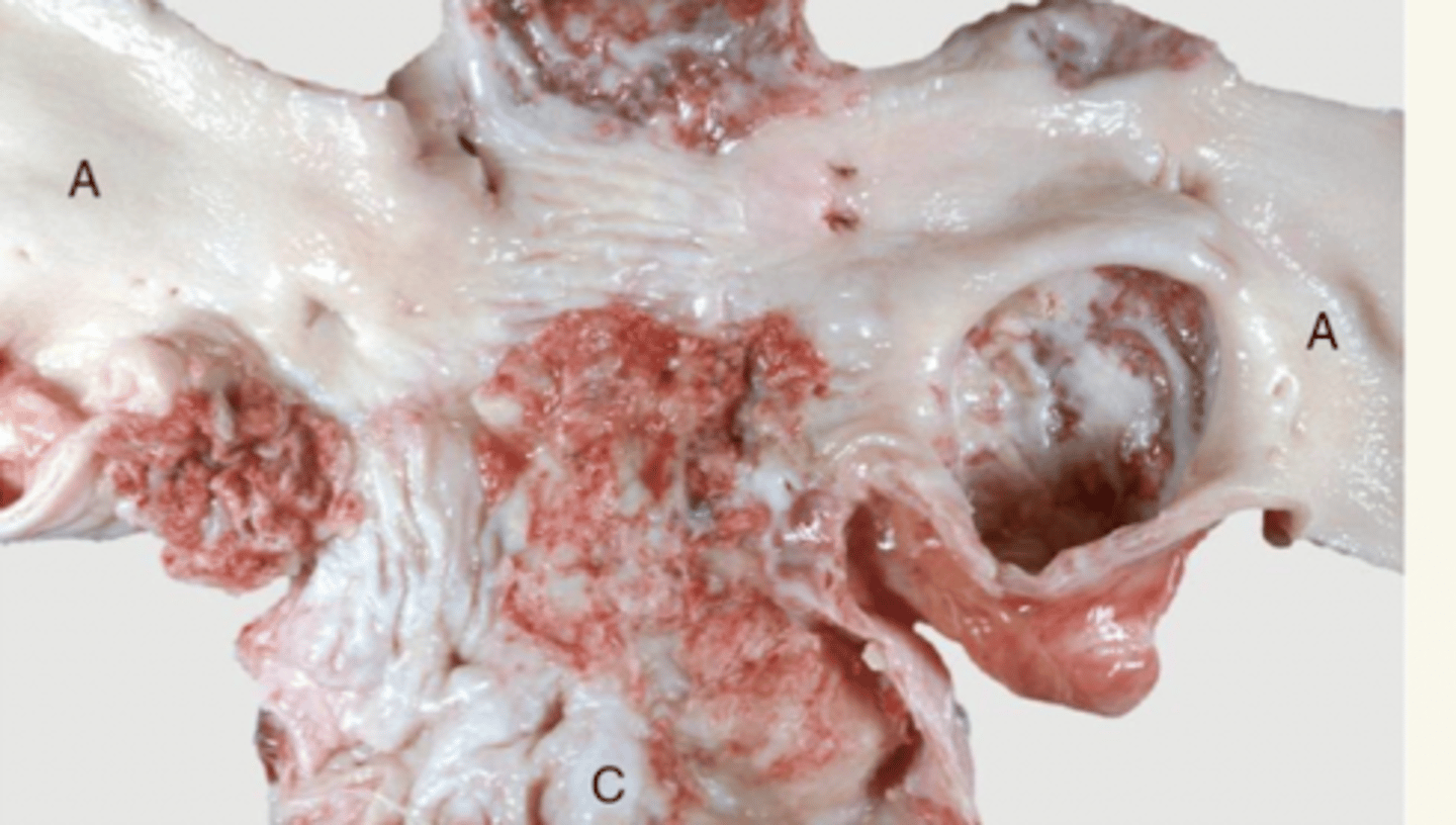 <p>arteria mesentérica craneal.</p><p>¿etiología?</p>