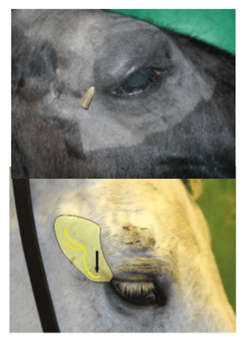 <p>adjacent to lateral canthus of eye</p>