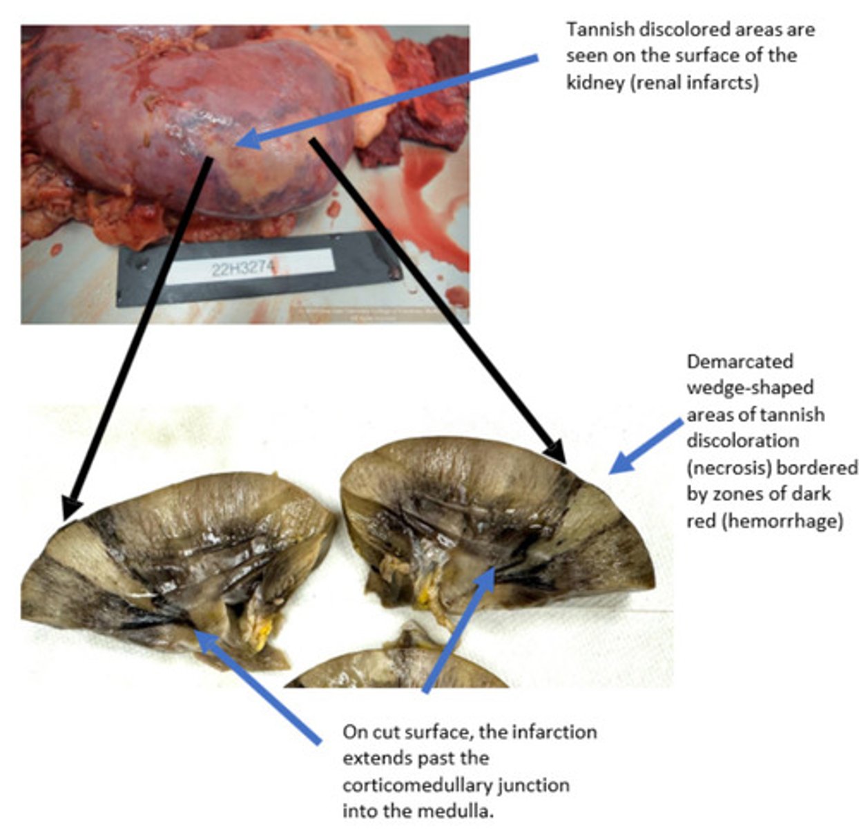 <p>What is lesion?</p>