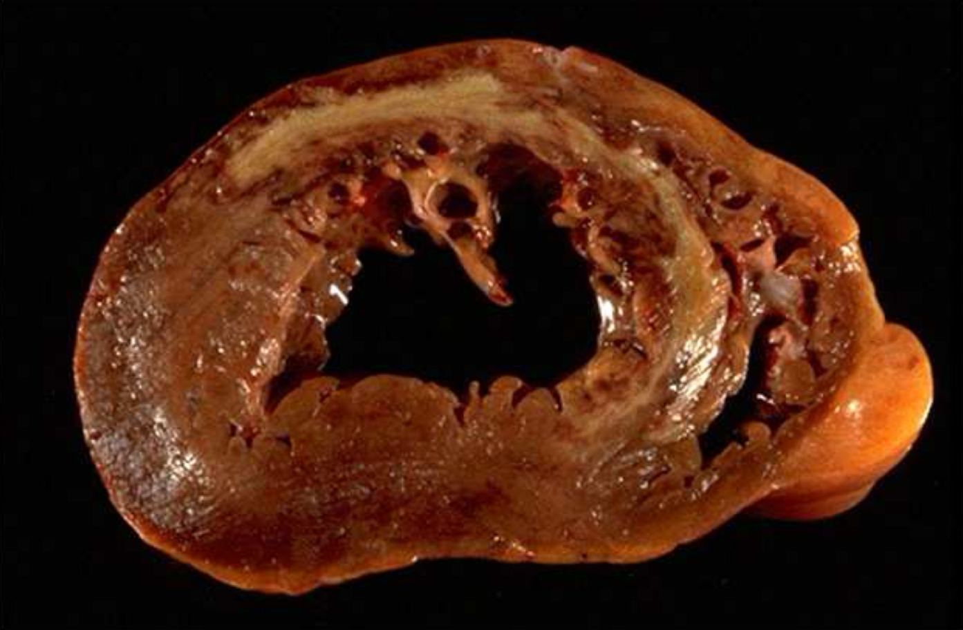 <p>What is this disease called</p><img src="blob:null/f2514450-ed30-4e21-93f8-026c6f86e8c1"><img src="blob:null/d84e900b-c573-4d4f-9695-e6b3e95026e4">