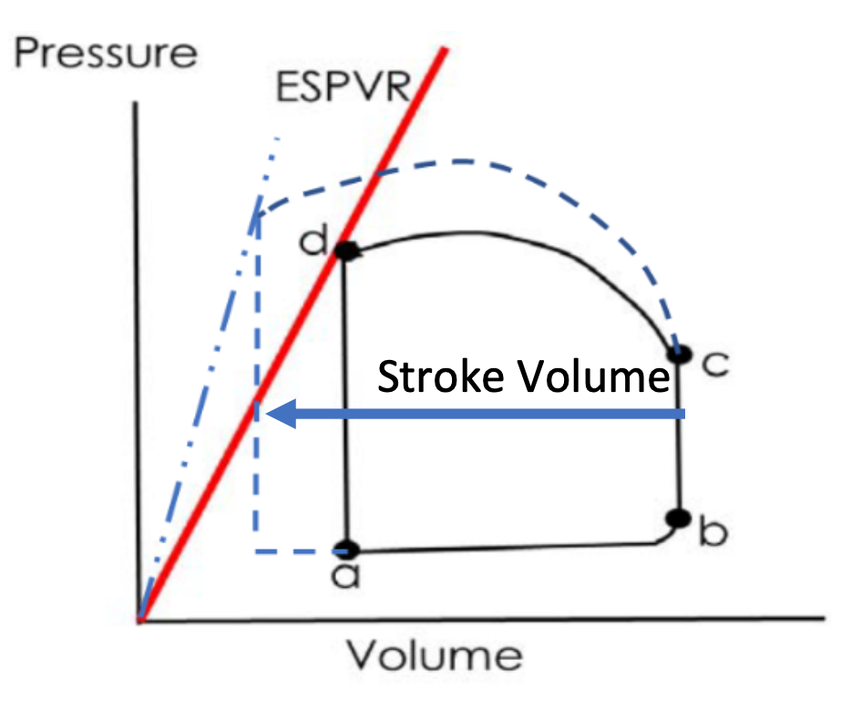 <ol><li><p>Contractility steepens ESPVR and increases SV</p></li><li><p>Sympathetic stimulation (Epi/NE)</p><ol><li><p>Steepens ESPRV</p></li><li><p>Increases strength of contraction</p></li><li><p>Increased pressure at a given volume</p></li></ol></li><li><p>ESPVR</p><ol><li><p>Origin to end-systole (d)</p></li><li><p>Big pressure at lowest volume</p><ol><li><p>Index of contractility</p></li></ol></li></ol></li></ol>