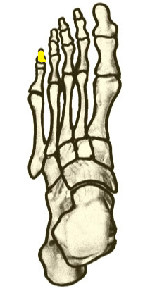 Name the highlighted foot bone
