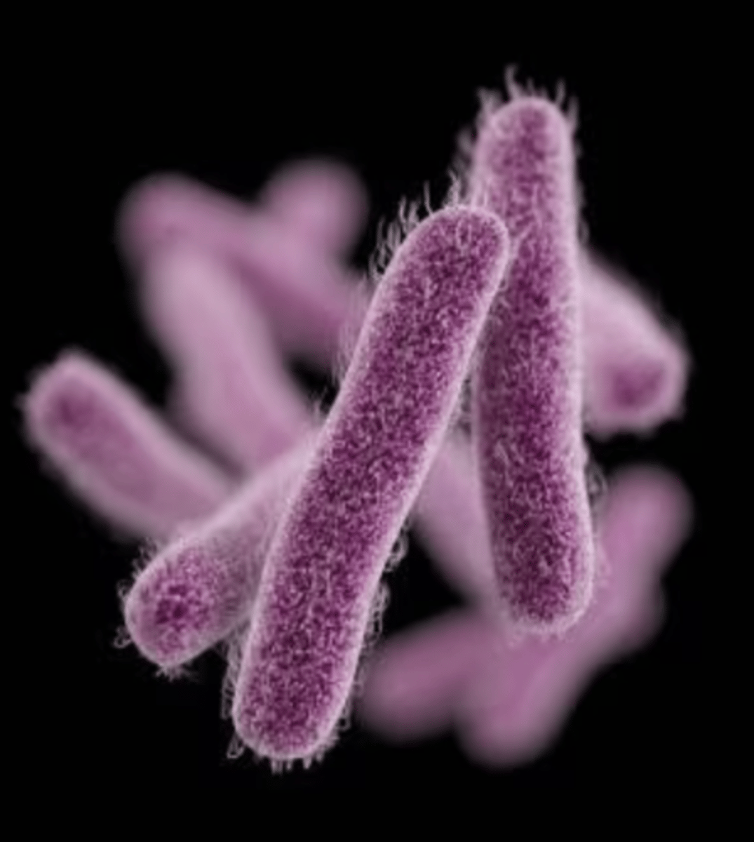 <p>Bacille Gram -</p><p>Immobile</p><p>Non capsulée</p><p>Non sporulée</p>