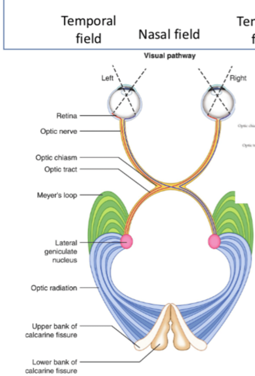 <p>Retina</p>