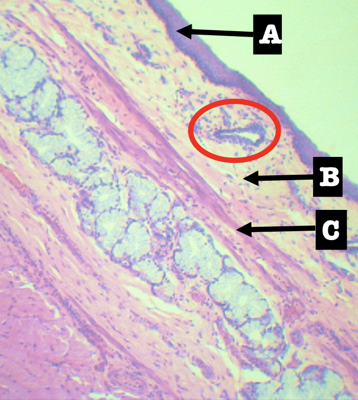 <p>Identify the morphology of the encircled structure</p>