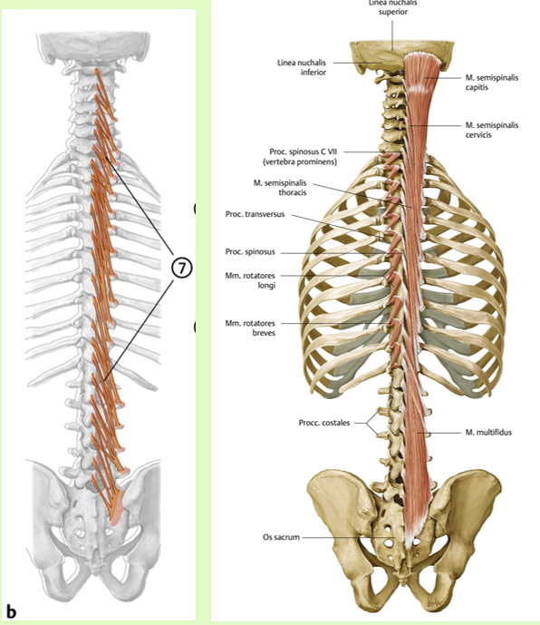 <p><span><span>Origo en insertie:<br></span></span><span data-name="black_small_square" data-type="emoji">▪</span><span><span> loopt tussen proc. spin. en<br>proc. trans. niveau -3 tot -5</span></span></p><p><span><span><br></span></span><span data-name="black_small_square" data-type="emoji">▪</span><span><span> Functie:<br></span></span><span data-name="black_small_square" data-type="emoji">▪</span><span><span> extensie, homolaterale<br>lateroflexie en heterolaterale<br>rotatie</span></span></p><p><span><span><br></span></span><span data-name="black_small_square" data-type="emoji">▪</span><span><span> Innervatie:<br></span></span><span data-name="black_small_square" data-type="emoji">▪</span><span><span> rr. Dorsales van spinale zenuw</span></span></p><p><br></p>