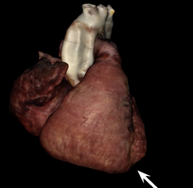 <p>What is the arrow pointing to?</p>