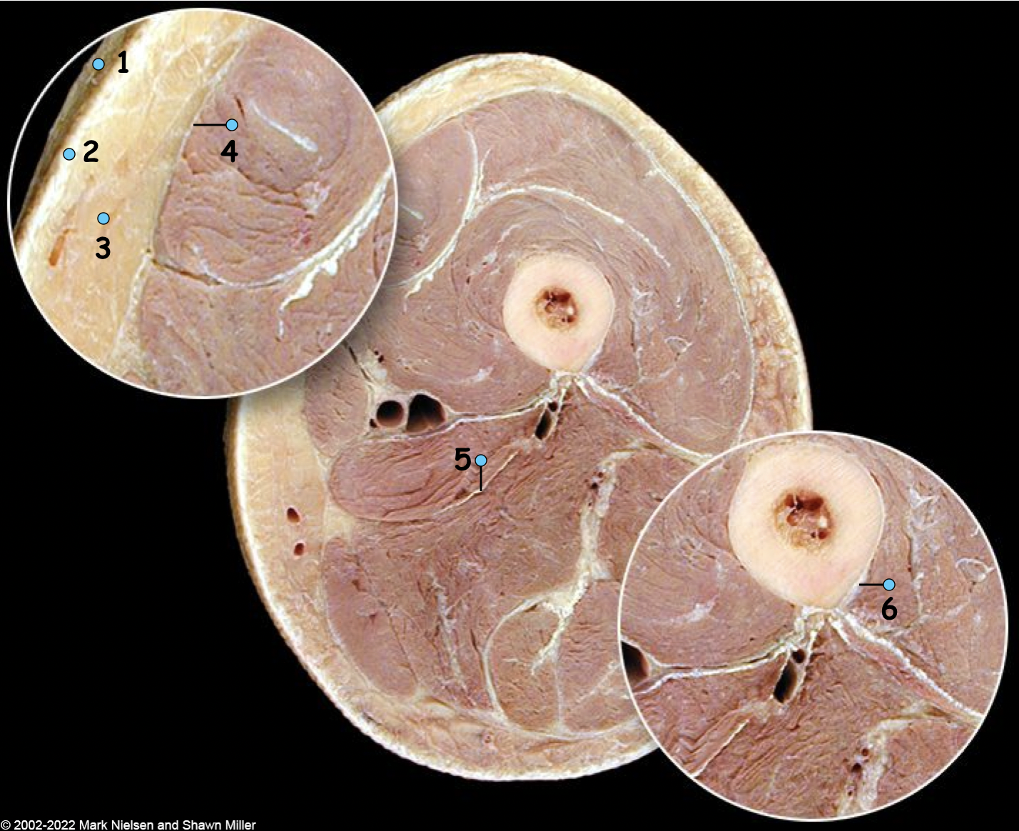 <p>What is number 5?</p>