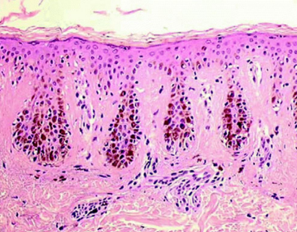 term image